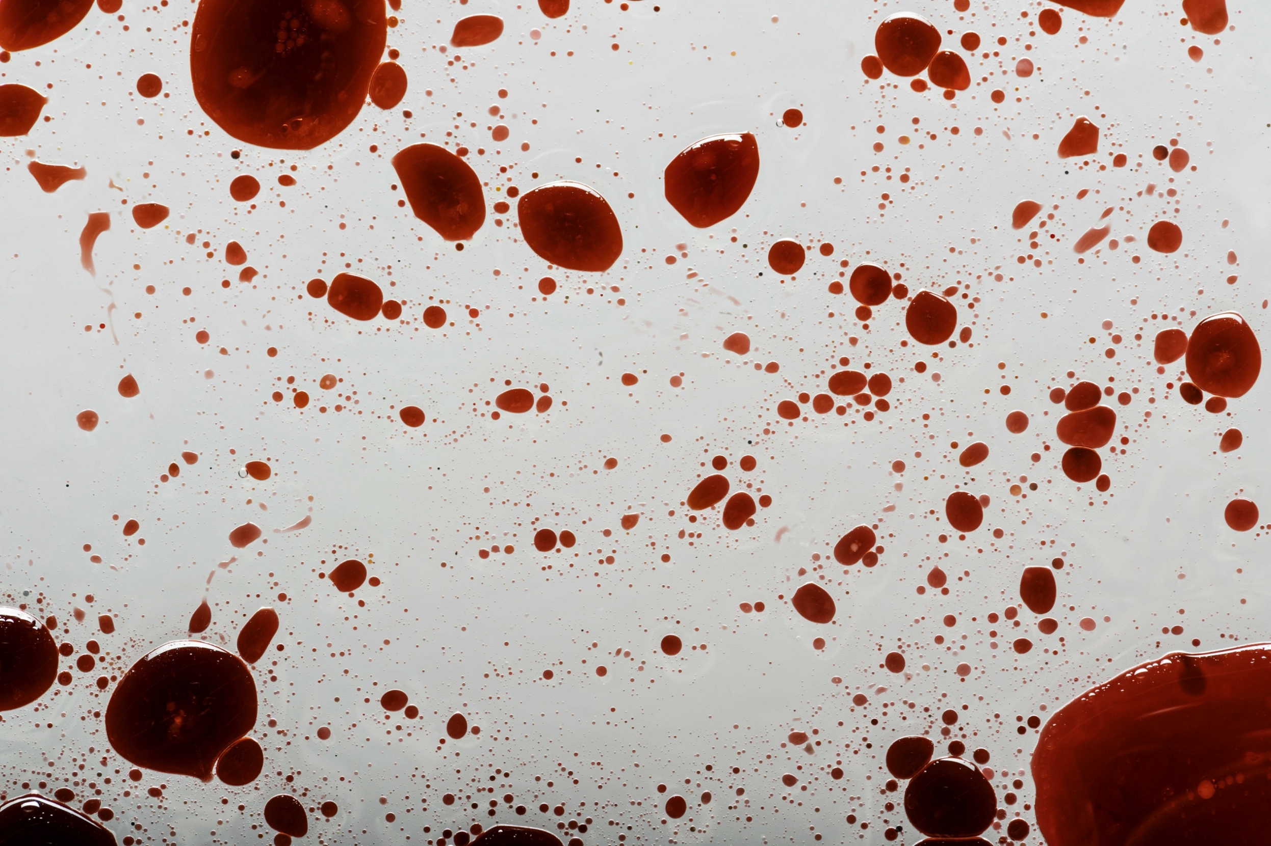 normal_infectious-coronavirus-blood-splatter-SLAQE4G~1~0.jpg